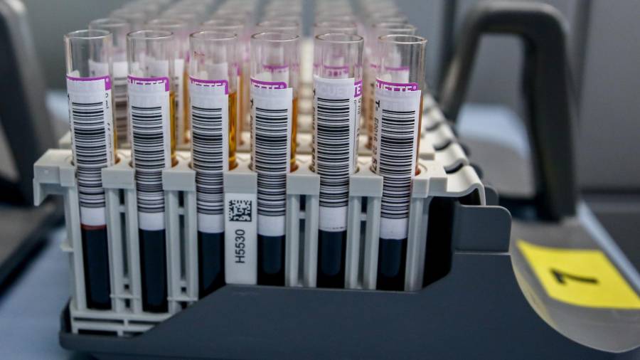 Tubos de sangre en el laboratorio del Centro de Transfusión de Valdebernardo